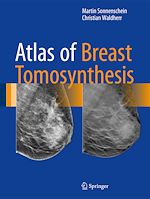 Télécharger le livre :  Atlas of Breast Tomosynthesis