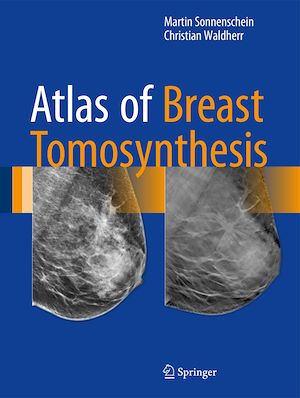 Téléchargez le livre :  Atlas of Breast Tomosynthesis
