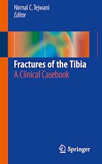 Télécharger le livre :  Fractures of the Tibia