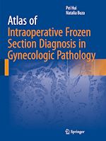 Télécharger le livre :  Atlas of Intraoperative Frozen Section Diagnosis in Gynecologic Pathology