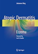 Télécharger le livre :  Atopic Dermatitis