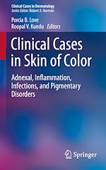 Télécharger le livre :  Clinical Cases in Skin of Color