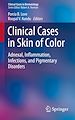 Télécharger le livre :  Clinical Cases in Skin of Color
