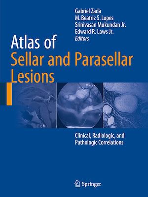 Téléchargez le livre :  Atlas of Sellar and Parasellar Lesions