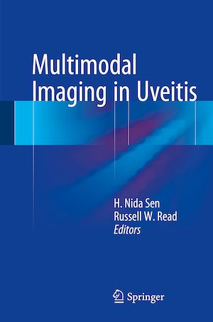 Téléchargez le livre :  Multimodal Imaging in Uveitis