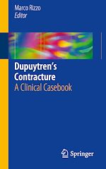 Télécharger le livre :  Dupuytren's Contracture