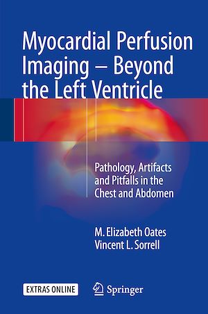 Téléchargez le livre :  Myocardial Perfusion Imaging - Beyond the Left Ventricle