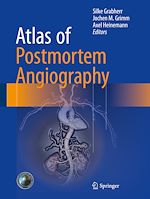 Télécharger le livre :  Atlas of Postmortem Angiography