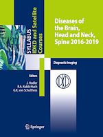 Télécharger le livre :  Diseases of the Brain, Head and Neck, Spine 2016-2019