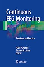 Télécharger le livre :  Continuous EEG Monitoring