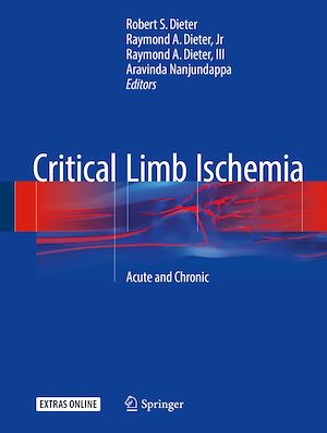 Téléchargez le livre :  Critical Limb Ischemia