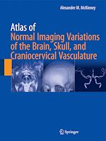 Télécharger le livre :  Atlas of Normal Imaging Variations of the Brain, Skull, and Craniocervical Vasculature
