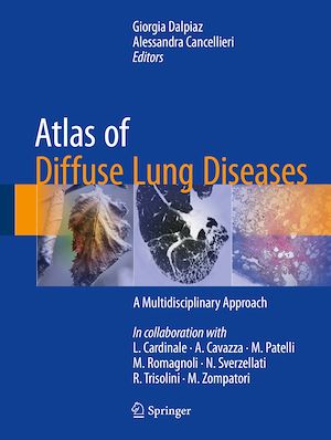 Téléchargez le livre :  Atlas of Diffuse Lung Diseases