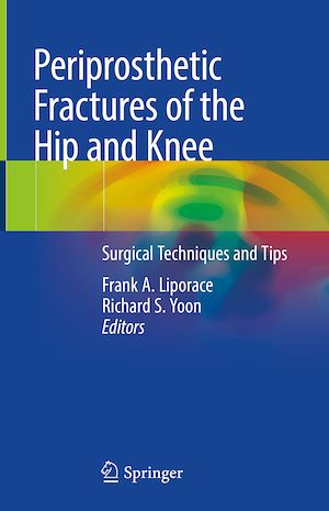 Téléchargez le livre :  Periprosthetic Fractures of the Hip and Knee