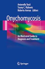Télécharger le livre :  Onychomycosis
