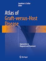 Télécharger le livre :  Atlas of Graft-versus-Host Disease