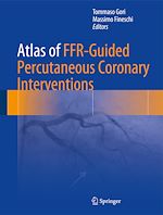 Télécharger le livre :  Atlas of FFR-Guided Percutaneous Coronary Interventions
