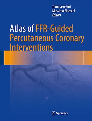 Téléchargez le livre :  Atlas of FFR-Guided Percutaneous Coronary Interventions