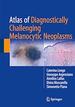 Télécharger le livre :  Atlas of Diagnostically Challenging Melanocytic Neoplasms