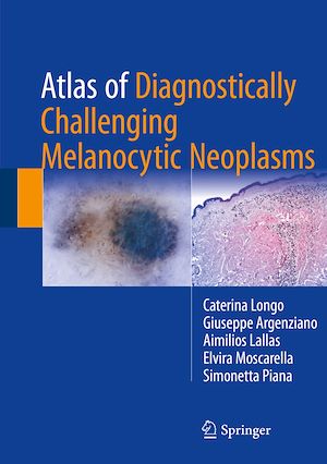 Téléchargez le livre :  Atlas of Diagnostically Challenging Melanocytic Neoplasms