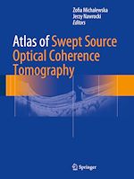Télécharger le livre :  Atlas of Swept Source Optical Coherence Tomography