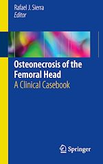 Télécharger le livre :  Osteonecrosis of the Femoral Head