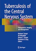 Télécharger le livre :  Tuberculosis of the Central Nervous System