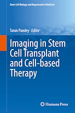 Download this eBook Imaging in Stem Cell Transplant and Cell-based Therapy
