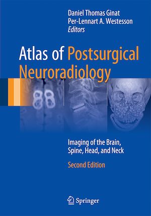 Téléchargez le livre :  Atlas of Postsurgical Neuroradiology