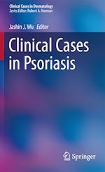 Télécharger le livre :  Clinical Cases in Psoriasis