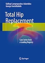 Télécharger le livre :  Total Hip Replacement