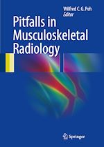 Télécharger le livre :  Pitfalls in Musculoskeletal Radiology