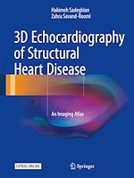 Télécharger le livre :  3D Echocardiography of Structural Heart Disease