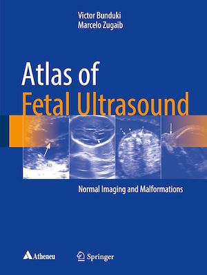 Téléchargez le livre :  Atlas of Fetal Ultrasound