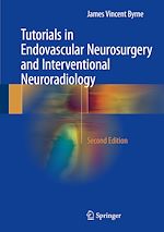 Télécharger le livre :  Tutorials in Endovascular Neurosurgery and Interventional Neuroradiology