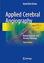Télécharger le livre :  Applied Cerebral Angiography