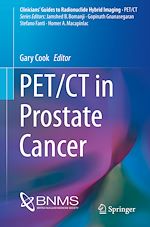 Télécharger le livre :  PET/CT in Prostate Cancer