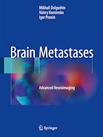 Télécharger le livre :  Brain Metastases