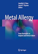 Télécharger le livre :  Metal Allergy