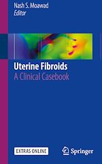 Télécharger le livre :  Uterine Fibroids
