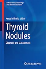Download this eBook Thyroid Nodules