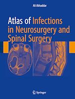 Télécharger le livre :  Atlas of Infections in Neurosurgery and Spinal Surgery