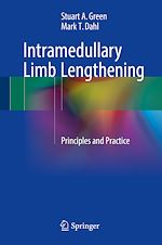 Télécharger le livre :  Intramedullary Limb Lengthening