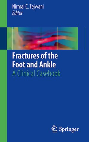 Téléchargez le livre :  Fractures of the Foot and Ankle