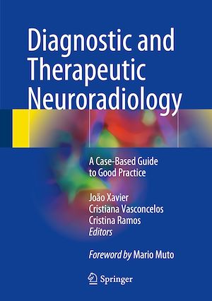 Téléchargez le livre :  Diagnostic and Therapeutic Neuroradiology