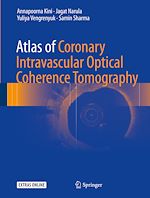 Télécharger le livre :  Atlas of Coronary Intravascular Optical Coherence Tomography