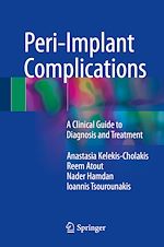 Télécharger le livre :  Peri-Implant Complications