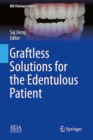 Téléchargez le livre :  Graftless Solutions for the Edentulous Patient