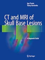 Télécharger le livre :  CT and MRI of Skull Base Lesions