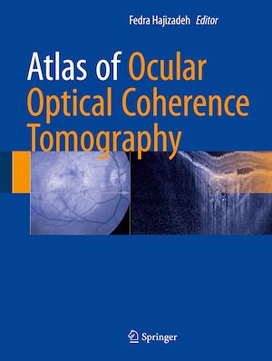 Téléchargez le livre :  Atlas of Ocular Optical Coherence Tomography